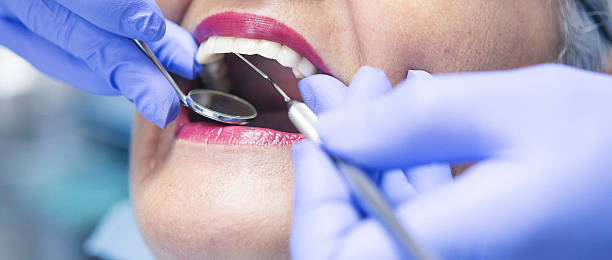 Best Broken or Chipped Tooth Repair in Fort Polk South, LA
