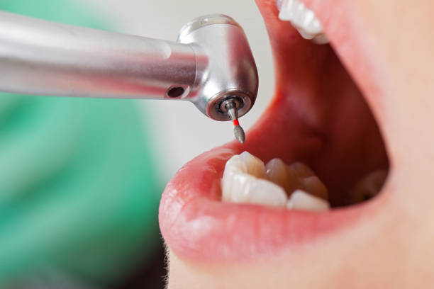 Trusted LA Emergency Dental Service Experts